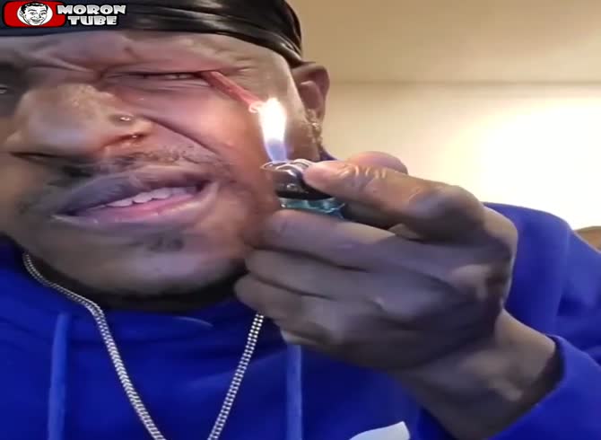 Video :Set a firework off in your eye Not a really smart concept